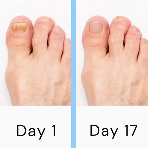 Dual Wavelength LED Nail Treatment Device with Automatic Slot Activation