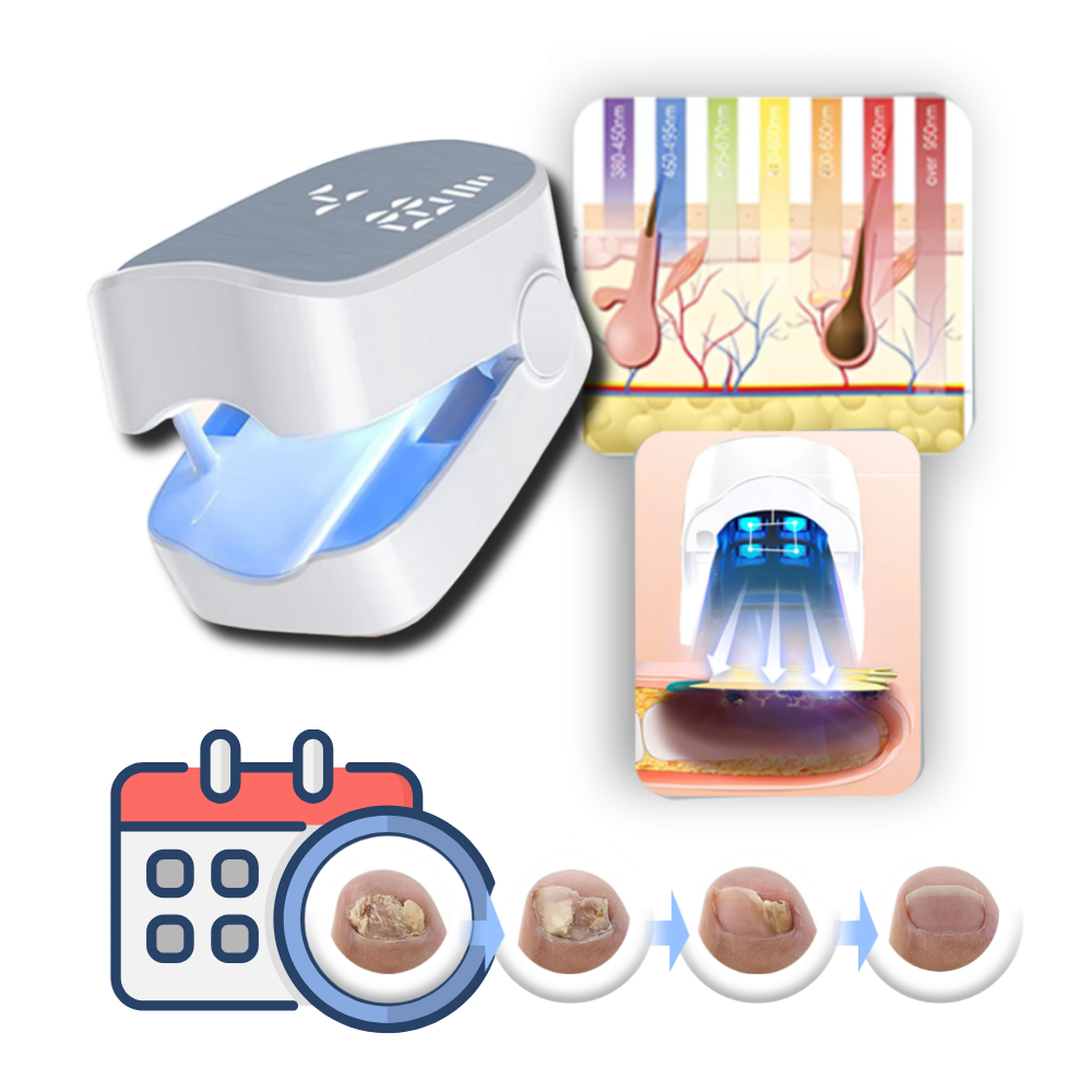 Dual Laser Nail Treatment Device with Blue Light and 7-Minute Sessions