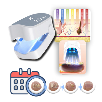 Dual Laser Nail Treatment Device with Blue Light and 7-Minute Sessions