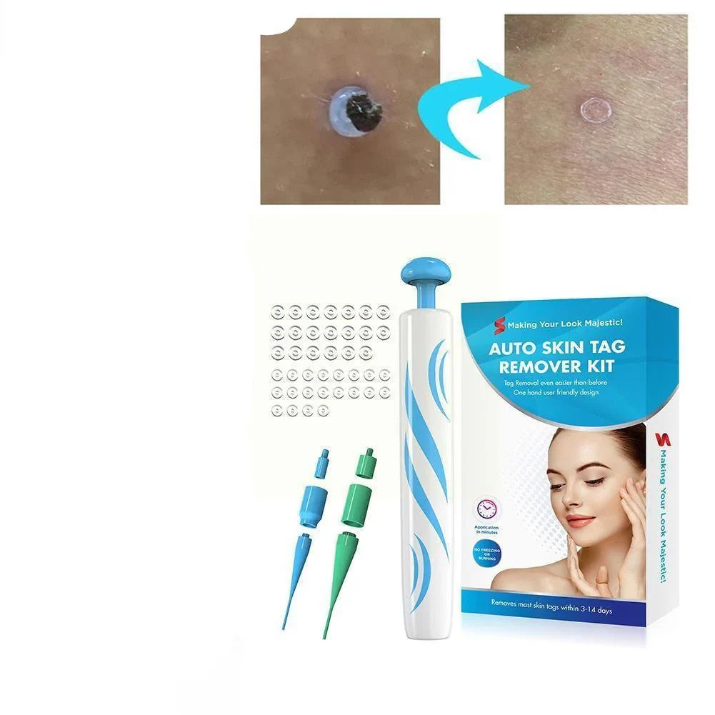 Skin Tag Removal Kit with Dual Spring Sizes and 10-Day Natural Process