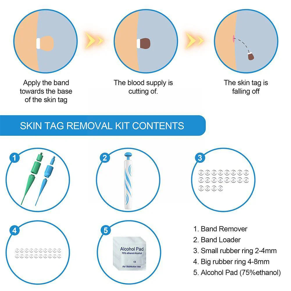Skin Tag Removal Kit with Dual Spring Sizes and 10-Day Natural Process
