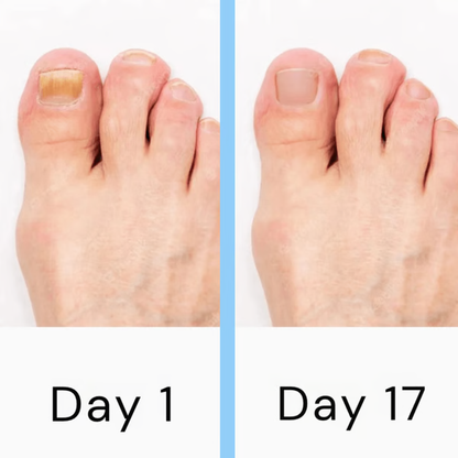 Dual Wavelength LED Nail Treatment Device with Automatic Slot Activation