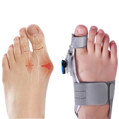 Adjustable Bunion Corrector with Twist Control and Heel Strap Support