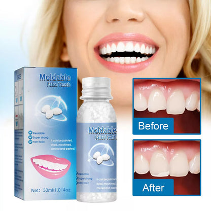 Moldable Polymer Tooth Replacement Kit with Boiling Water Activation and Sandpaper Finishing