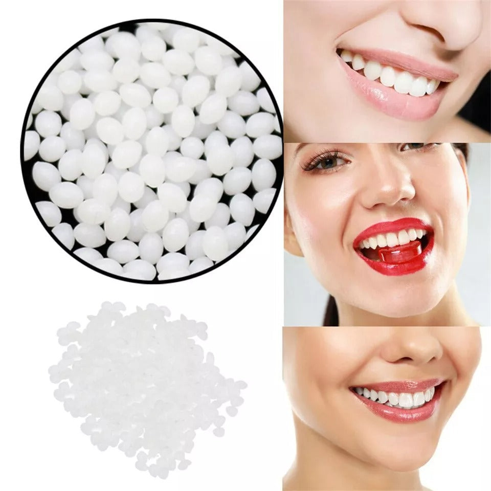 Moldable Polymer Tooth Replacement Kit with Boiling Water Activation and Sandpaper Finishing