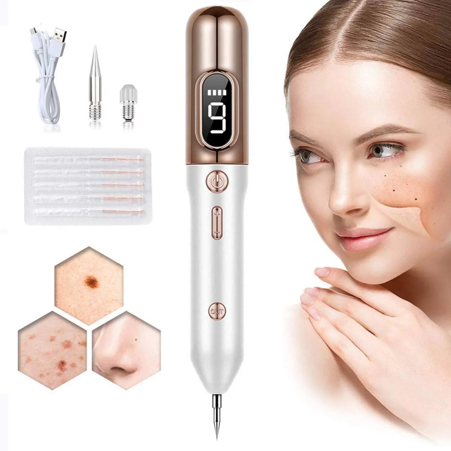 Plasma Spot Removal Pen with Adjustable Intensity and Interchangeable Tips